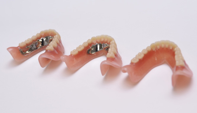 フェアリー加工義歯 写真3
